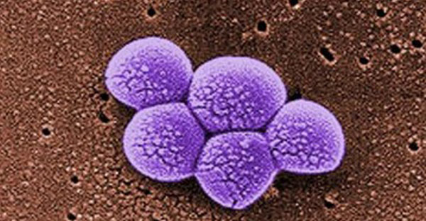Bacteria