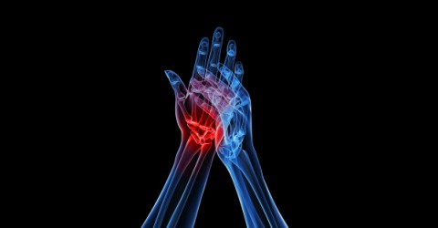 Arthritis Joint Pain